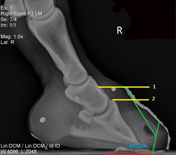 Lateral X-ray